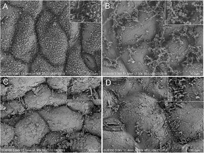 The Microbiota Dynamics of Alfalfa Silage During Ensiling and After Air Exposure, and the Metabolomics After Air Exposure Are Affected by Lactobacillus casei and Cellulase Addition